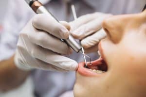 איך נתכונן לטיפולי שיניים שורש
